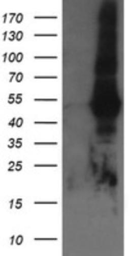 Western Blot: Tapasin Related Protein Antibody (4H5) [NBP2-46066] - Analysis of HEK293T cells were transfected with the pCMV6-ENTRY control (Left lane) or pCMV6-ENTRY Tapasin Related Protein.