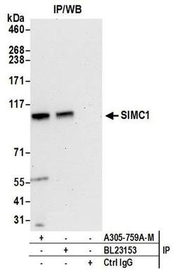 Detection of human SIMC1 by WB of IP.