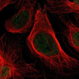 Immunocytochemistry/Immunofluorescence: HLTF Antibody [NBP1-83256] - Staining of human cell line U-2 OS shows positivity in nucleus but not nucleoli.