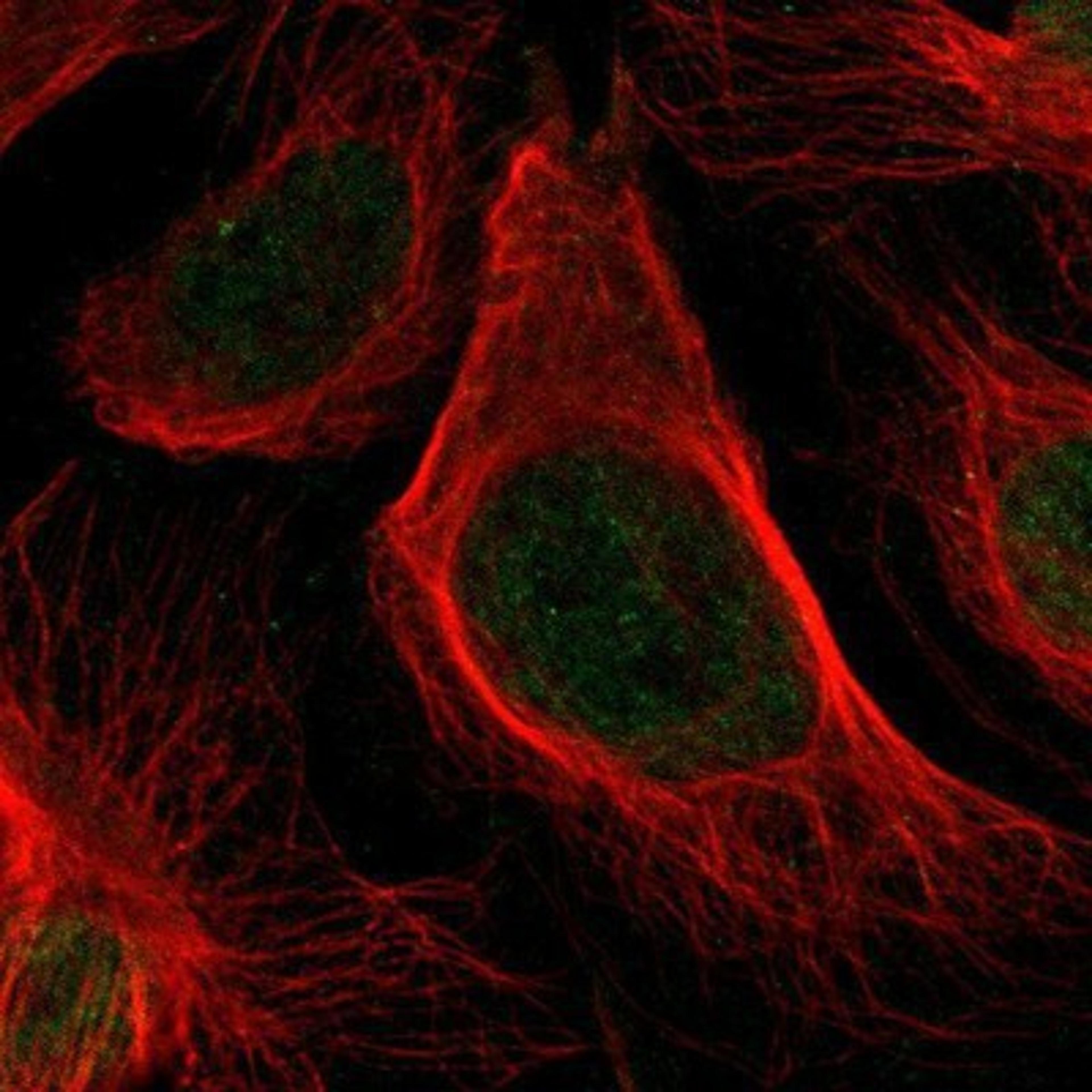 Immunocytochemistry/Immunofluorescence: HLTF Antibody [NBP1-83256] - Staining of human cell line U-2 OS shows positivity in nucleus but not nucleoli.