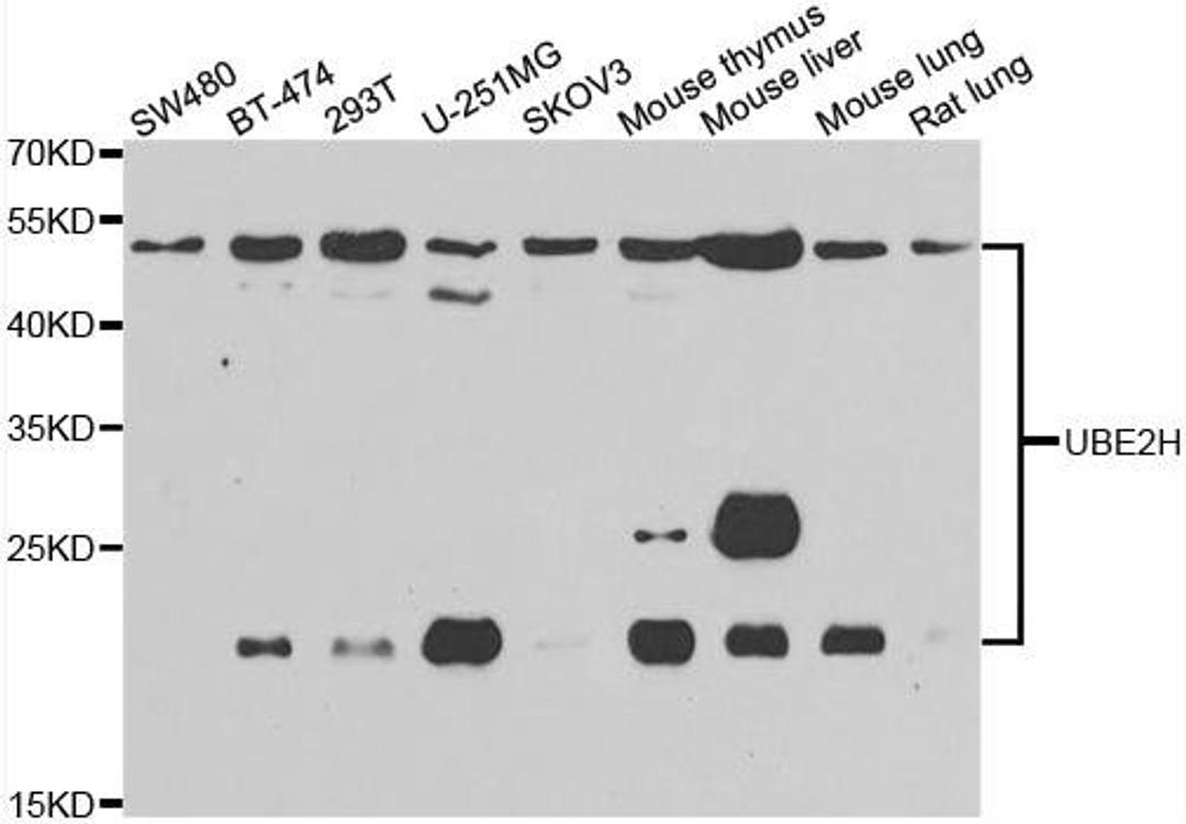 Western blot analysis of extracts of various cell lines using UBE2H antibody