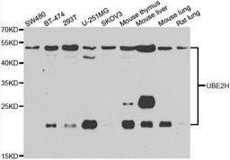 Western blot analysis of extracts of various cell lines using UBE2H antibody