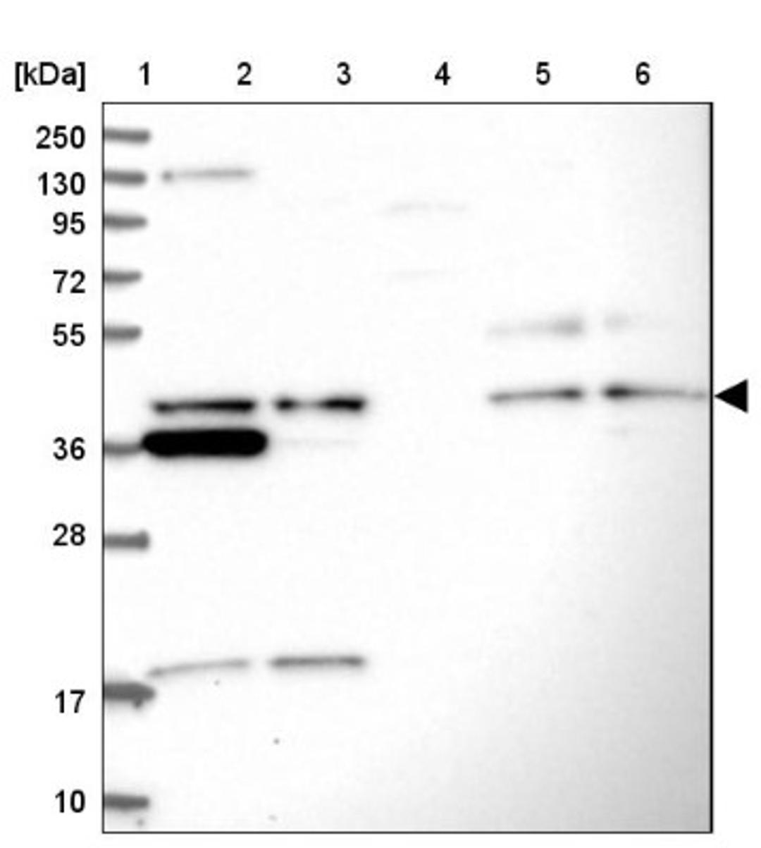 Western Blot: UBL7 Antibody [NBP1-88566] - Lane 1: Marker [kDa] 250, 130, 95, 72, 55, 36, 28, 17, 10<br/>Lane 2: Human cell line RT-4<br/>Lane 3: Human cell line U-251MG sp<br/>Lane 4: Human plasma (IgG/HSA depleted)<br/>Lane 5: Human liver tissue<br/>Lane 6: Human tonsil tissue