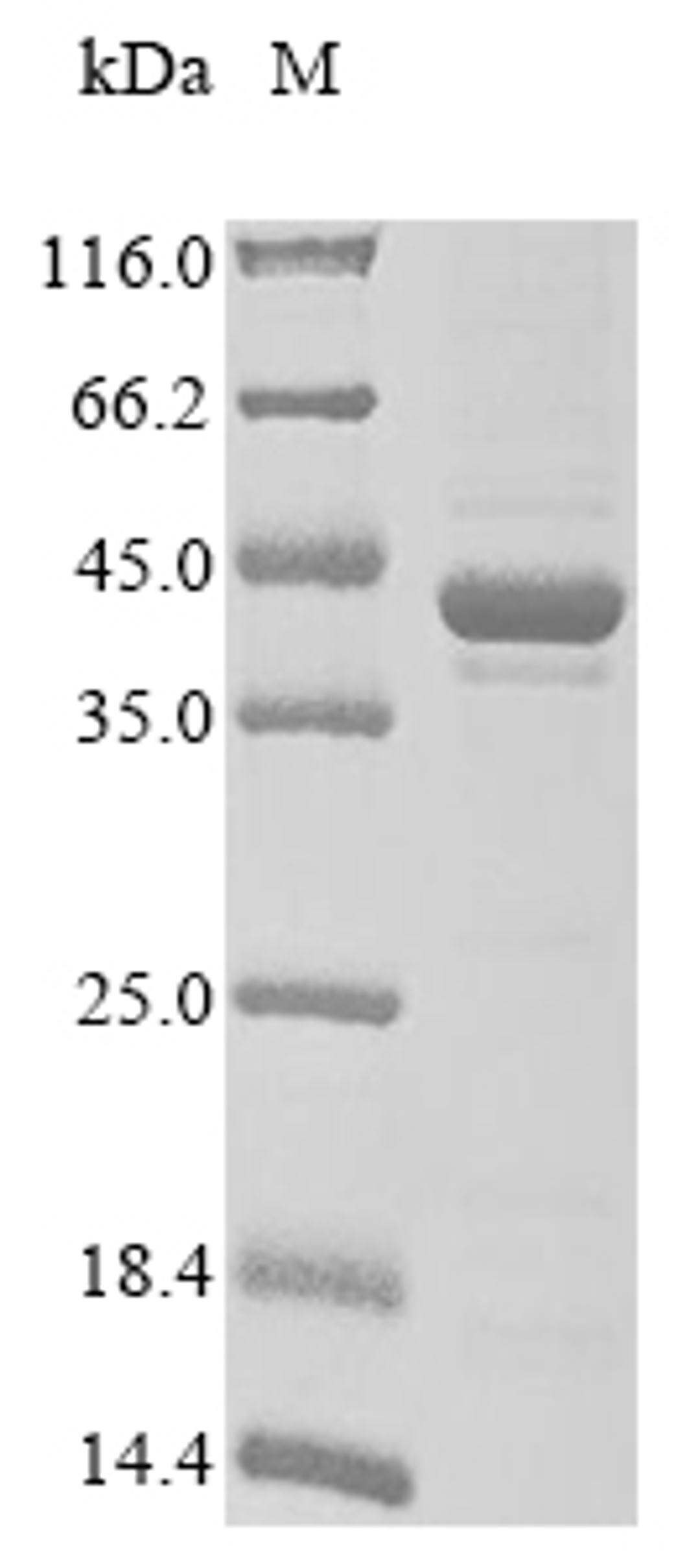 (Tris-Glycine gel) Discontinuous SDS-PAGE (reduced) with 5% enrichment gel and 15% separation gel.