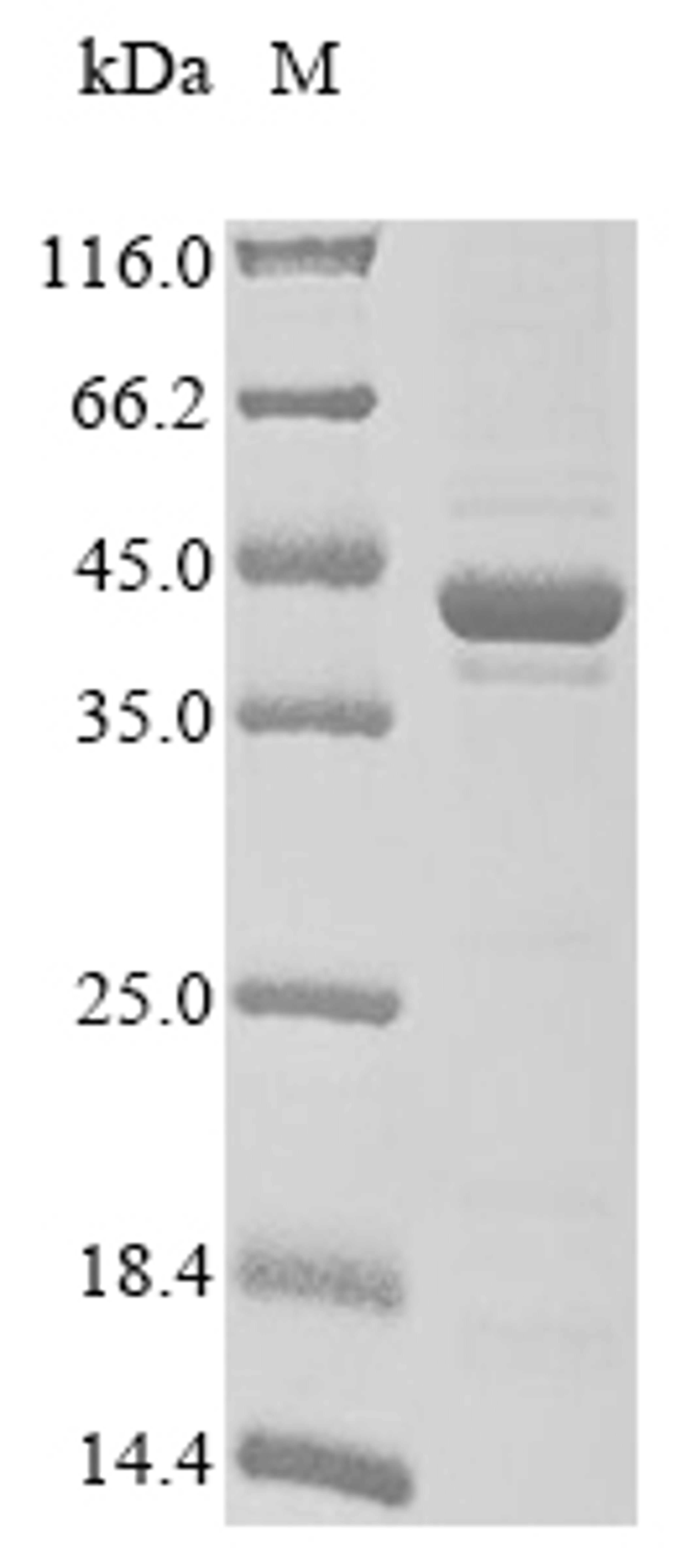 (Tris-Glycine gel) Discontinuous SDS-PAGE (reduced) with 5% enrichment gel and 15% separation gel.