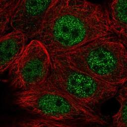 Immunocytochemistry/Immunofluorescence: COQ6 Antibody [NBP2-13860] - Staining of human cell line MCF-7 shows positivity in nucleus but not nucleoli.