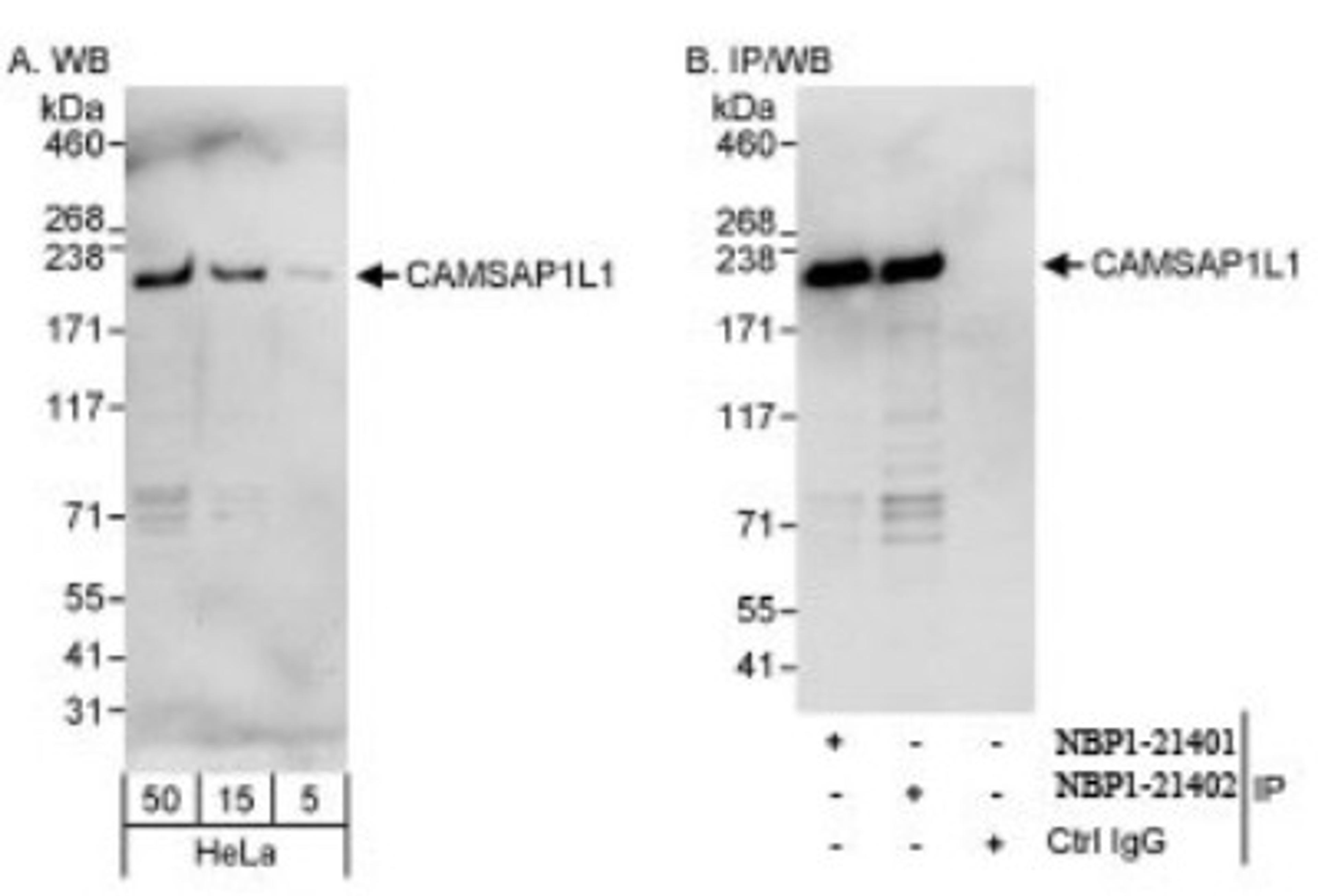 Western Blot: CAMSAP1L1 Antibody [NBP1-21402] - on HeLa whole cell lysate using anti-CAMSAP1L1 antibody. CAMSAP1L1 was also  immunoprecipitated by rabbit anti-CAMSAP1L1 antibody NBP1-21401.