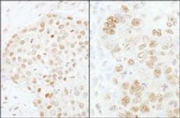 Detection of human and mouse CPSF73 by immunohistochemistry.