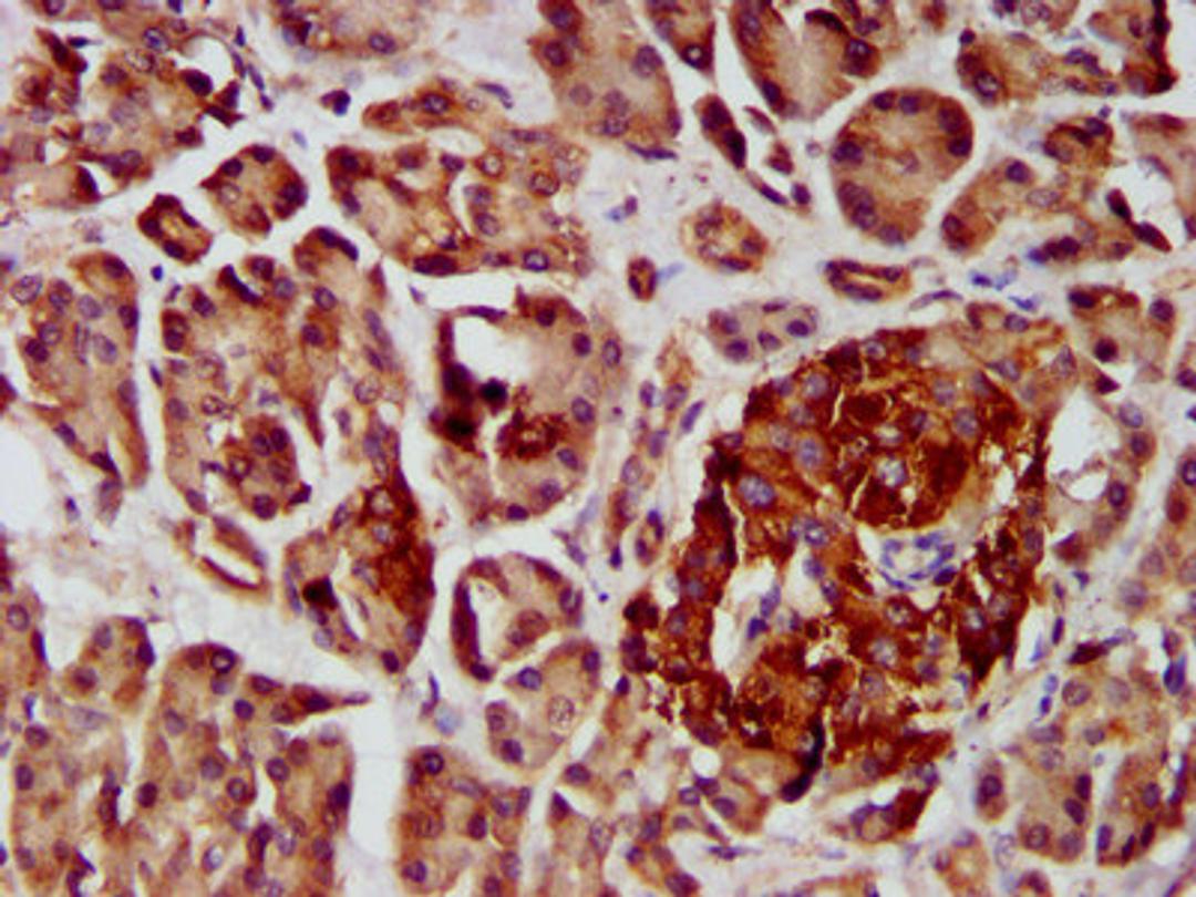 IHC image of CSB-PA866200LA01HU diluted at 1:400 and staining in paraffin-embedded human pancreatic tissue performed on a Leica BondTM system. After dewaxing and hydration, antigen retrieval was mediated by high pressure in a citrate buffer (pH 6.0). Section was blocked with 10% normal goat serum 30min at RT. Then primary antibody (1% BSA) was incubated at 4&deg;C overnight. The primary is detected by a biotinylated secondary antibody and visualized using an HRP conjugated SP system.