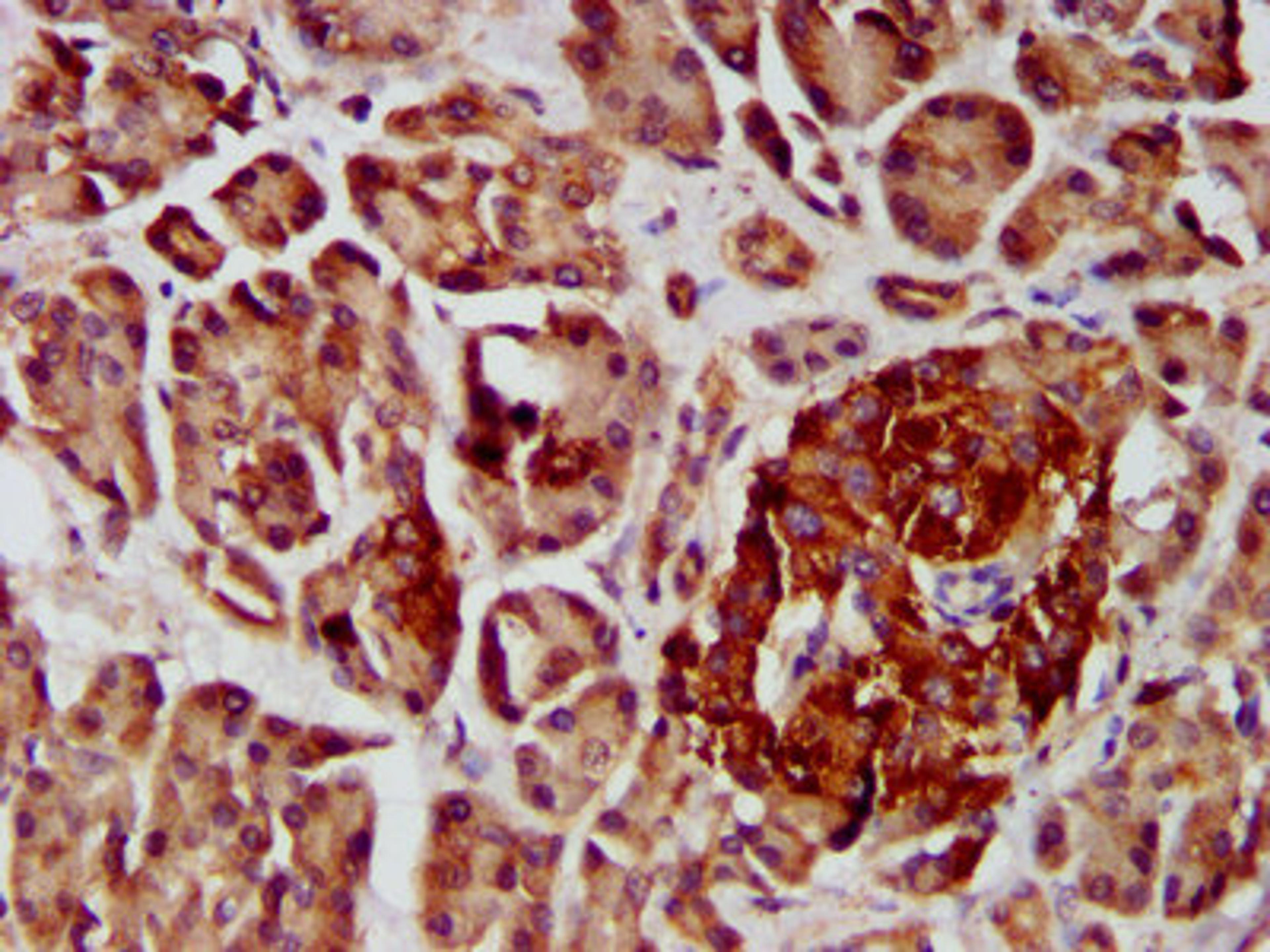 IHC image of CSB-PA866200LA01HU diluted at 1:400 and staining in paraffin-embedded human pancreatic tissue performed on a Leica BondTM system. After dewaxing and hydration, antigen retrieval was mediated by high pressure in a citrate buffer (pH 6.0). Section was blocked with 10% normal goat serum 30min at RT. Then primary antibody (1% BSA) was incubated at 4&deg;C overnight. The primary is detected by a biotinylated secondary antibody and visualized using an HRP conjugated SP system.