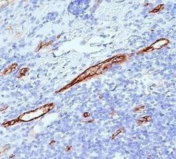 IHC staining of human tonsil with von Willebrand Factor antibody (VWF635).