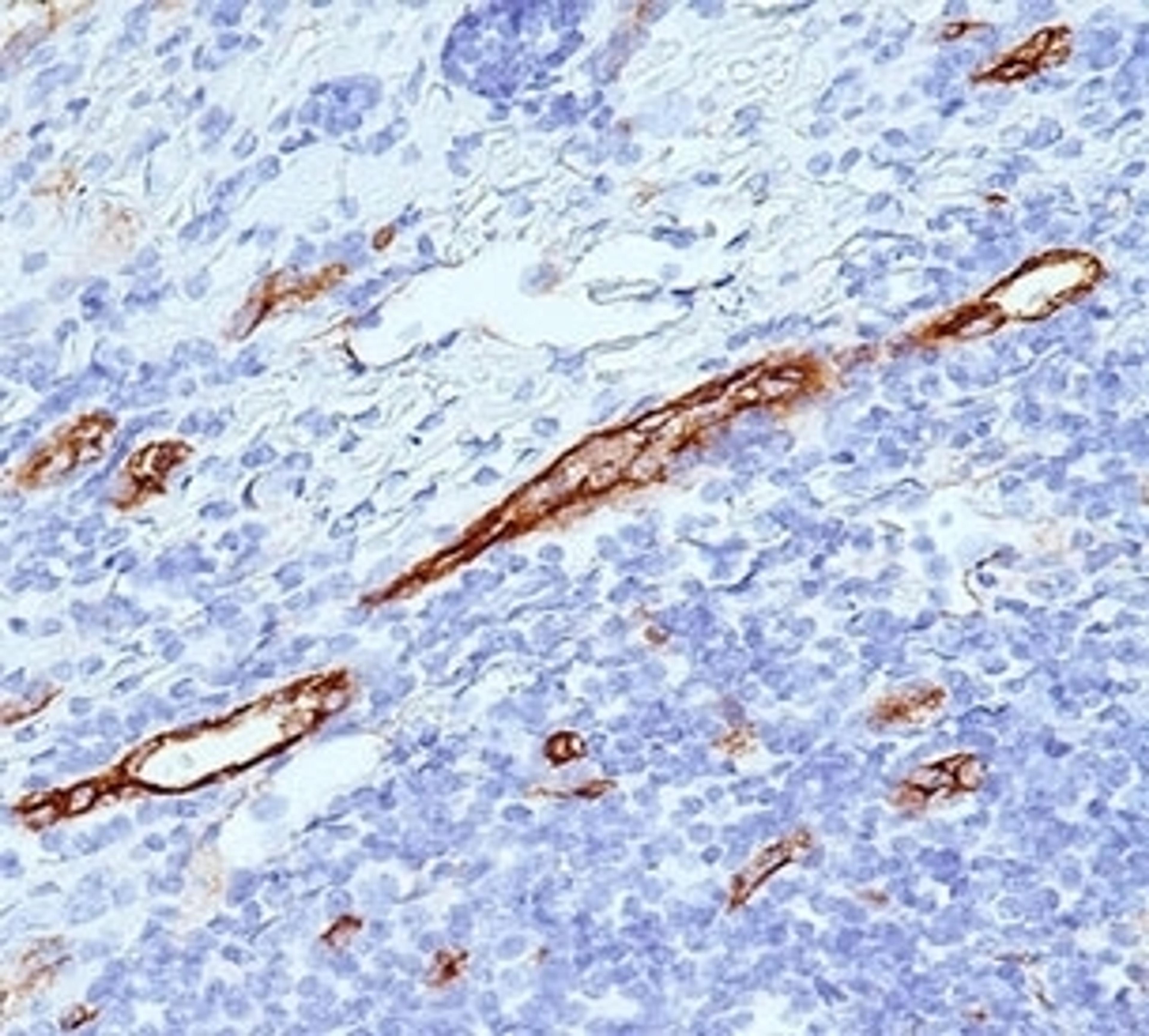 IHC staining of human tonsil with von Willebrand Factor antibody (VWF635).