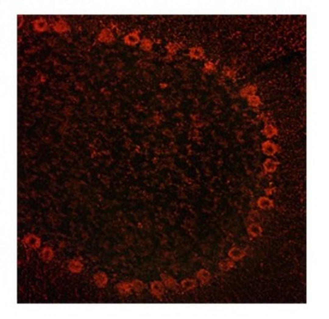 Immunocytochemistry/Immunofluorescence: ADAM15 Antibody [NBP1-59198] - rat and mouse brain, 10 ug/ml.  Observed staining in cytoplasmin neurons