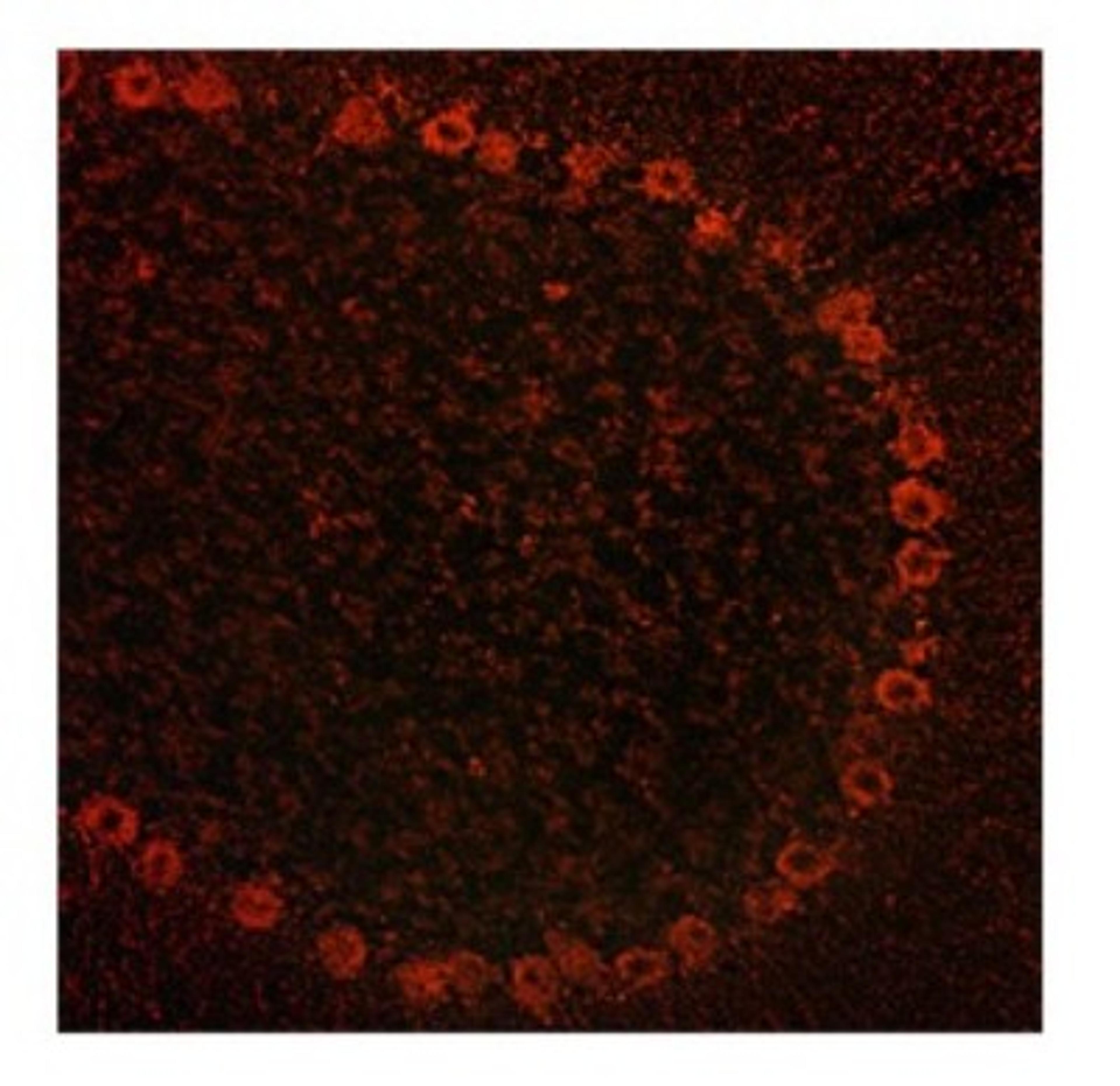 Immunocytochemistry/Immunofluorescence: ADAM15 Antibody [NBP1-59198] - rat and mouse brain, 10 ug/ml.  Observed staining in cytoplasmin neurons