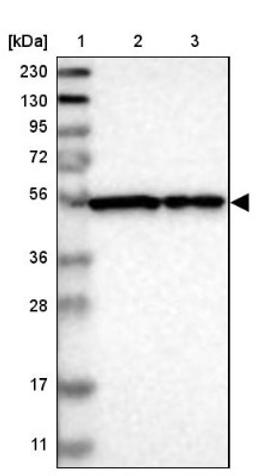 Western Blot: FKBP9 Antibody [NBP1-83887] - Lane 1: Marker [kDa] 230, 130, 95, 72, 56, 36, 28, 17, 11<br/>Lane 2: Human cell line RT-4<br/>Lane 3: Human cell line U-251MG sp