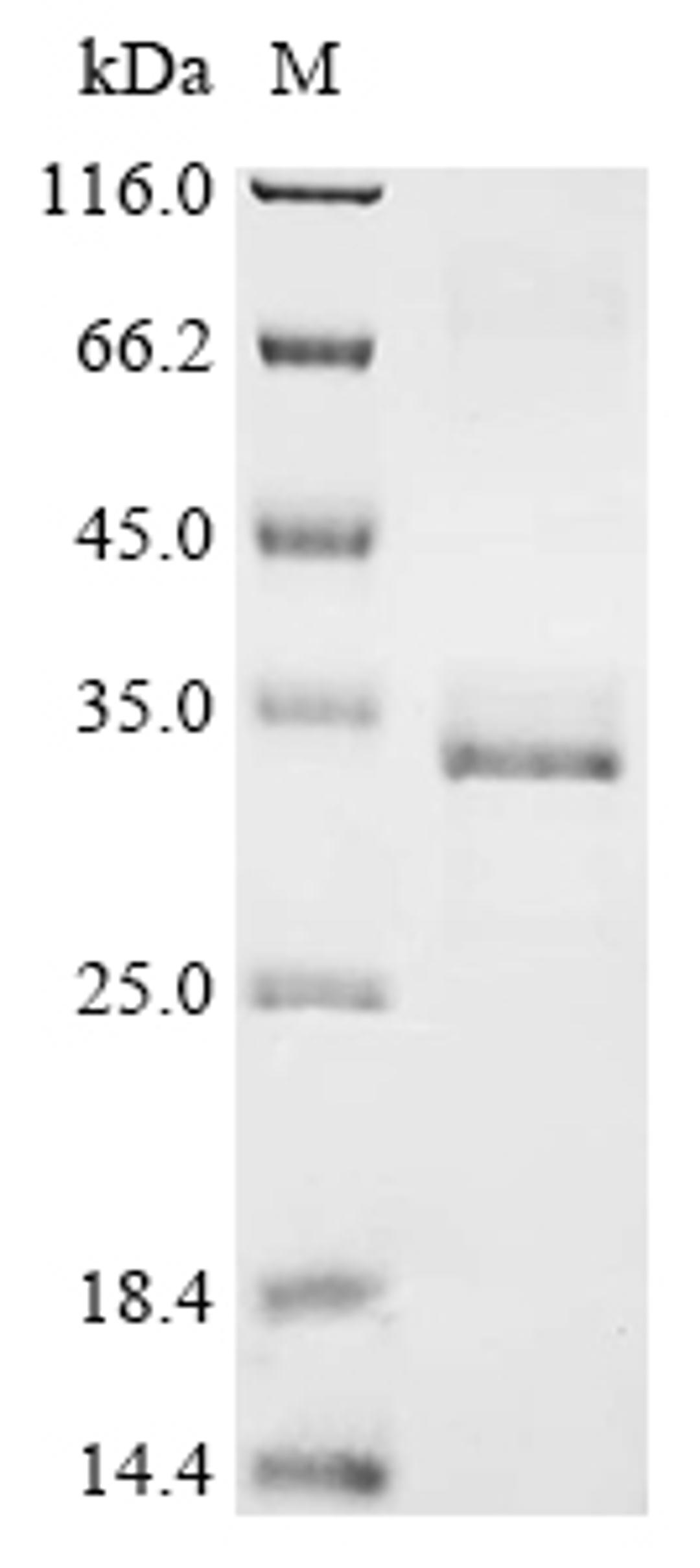 (Tris-Glycine gel) Discontinuous SDS-PAGE (reduced) with 5% enrichment gel and 15% separation gel.