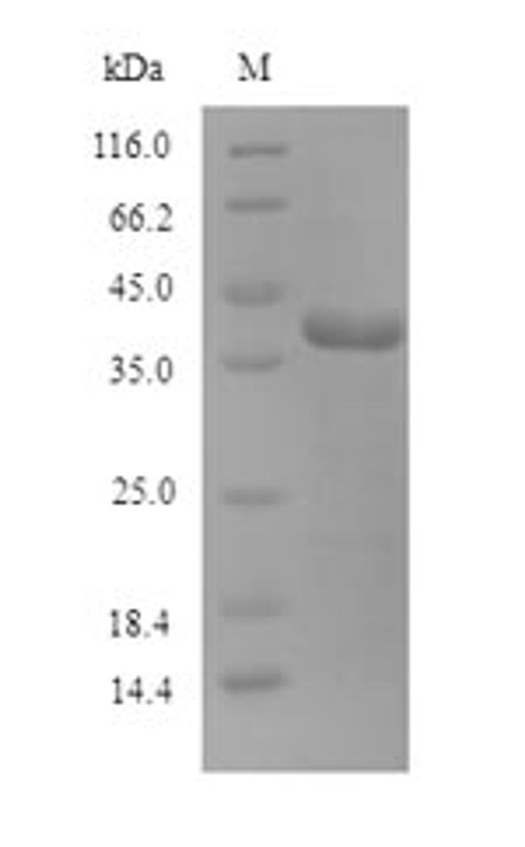 (Tris-Glycine gel) Discontinuous SDS-PAGE (reduced) with 5% enrichment gel and 15% separation gel.