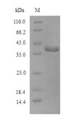 (Tris-Glycine gel) Discontinuous SDS-PAGE (reduced) with 5% enrichment gel and 15% separation gel.