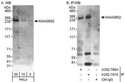 Detection of human KIAA0802 by western blot of immunoprecipitates.