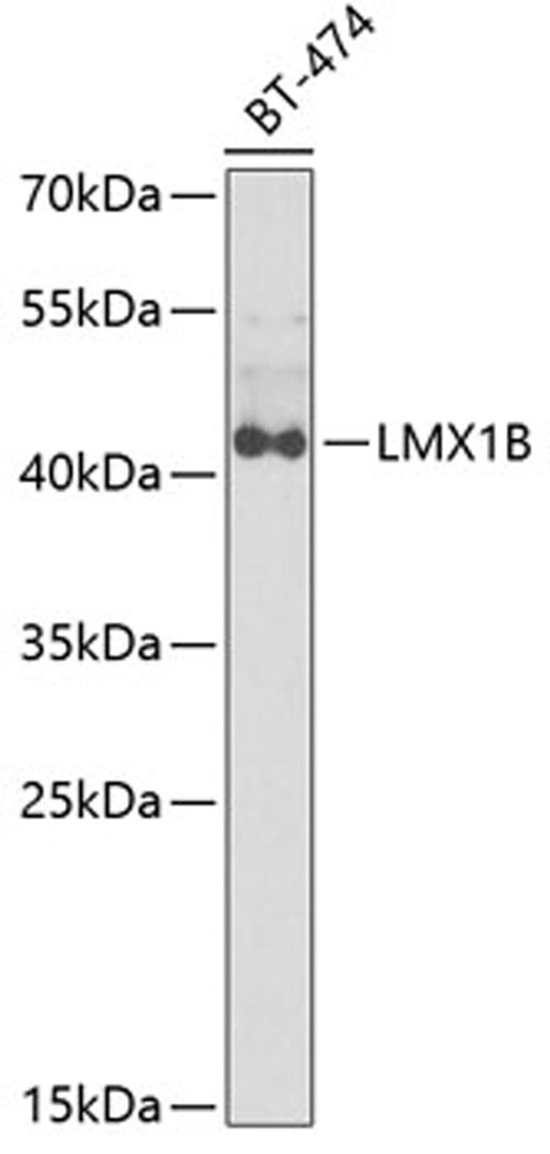 Western blot - LMX1B antibody (A6386)