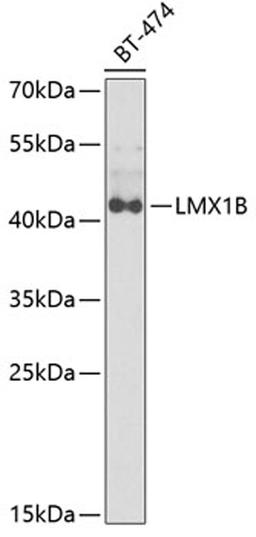 Western blot - LMX1B antibody (A6386)