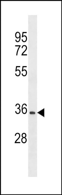 Western blot analysis in CEM cell line lysates (35ug/lane).