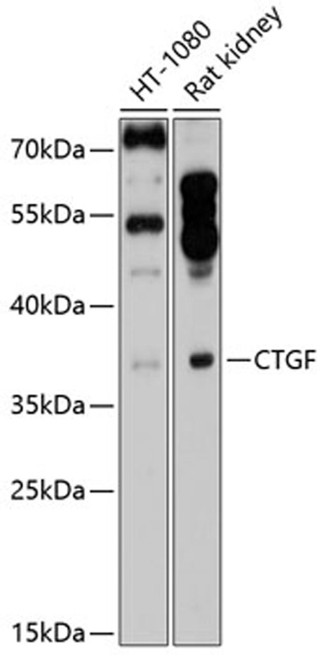 Western blot - CTGF antibody (A11067)