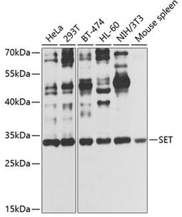 Western blot - SET antibody (A12502)