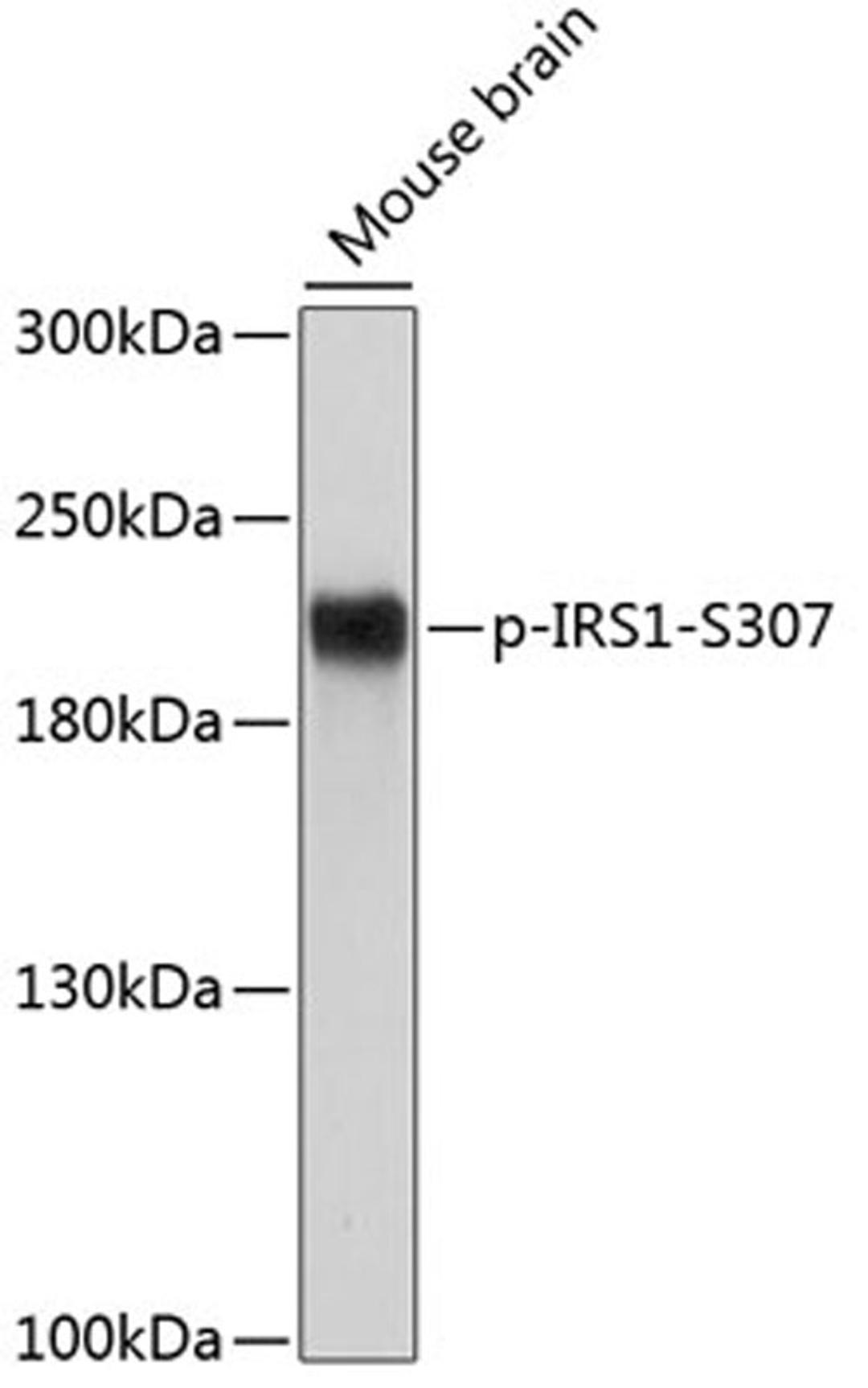 Western blot - Phospho-IRS1-S307 antibody (AP0552)