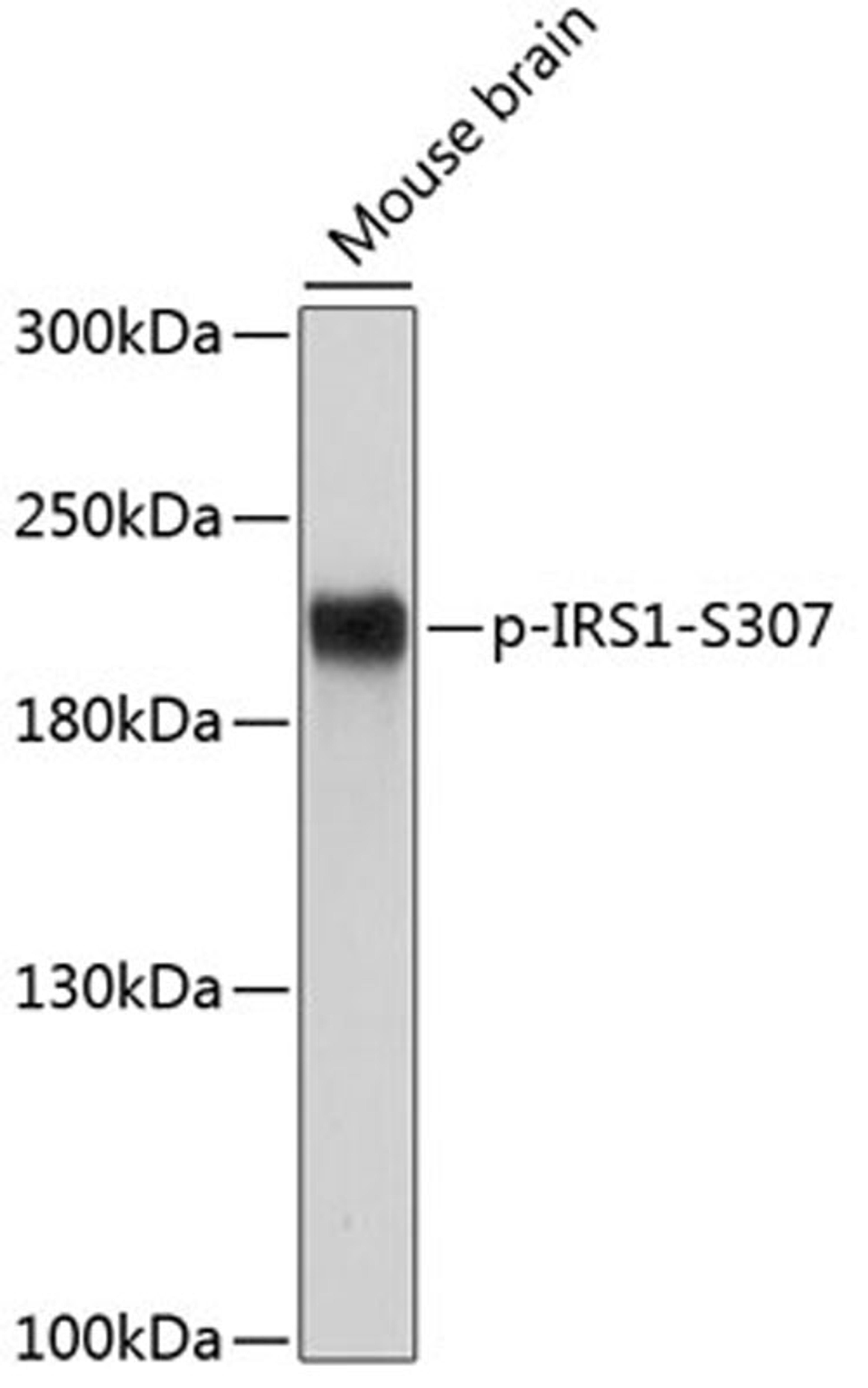 Western blot - Phospho-IRS1-S307 antibody (AP0552)