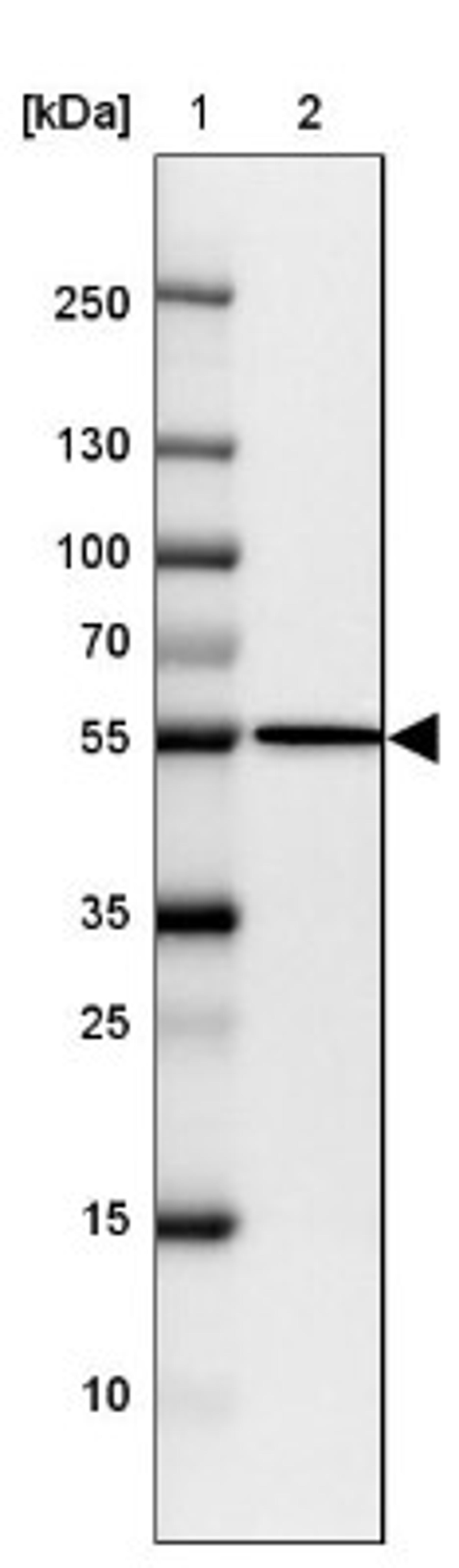 Western Blot: FIGNL1 Antibody [NBP2-47456] - Lane 1: Marker [kDa] 250, 130, 100, 70, 55, 35, 25, 15, 10.  Lane 2: Human cell line CACO-2