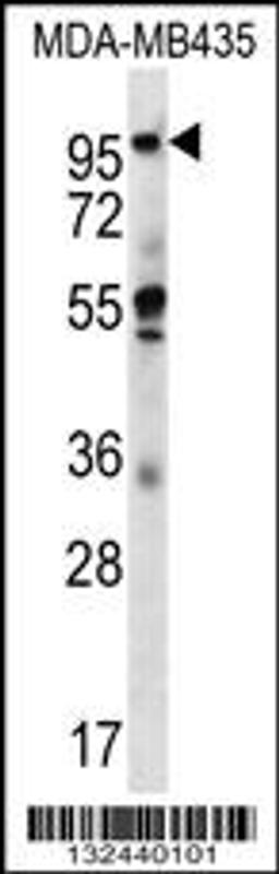 Western blot analysis in MDA-MB435 cell line lysates (35ug/lane).