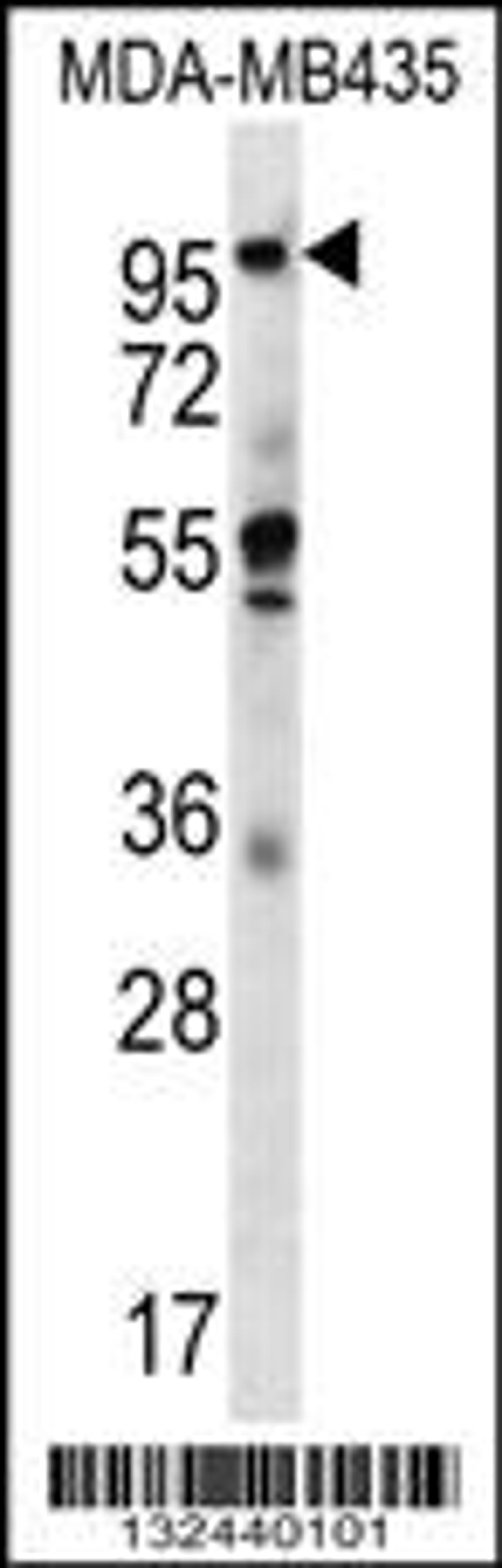 Western blot analysis in MDA-MB435 cell line lysates (35ug/lane).