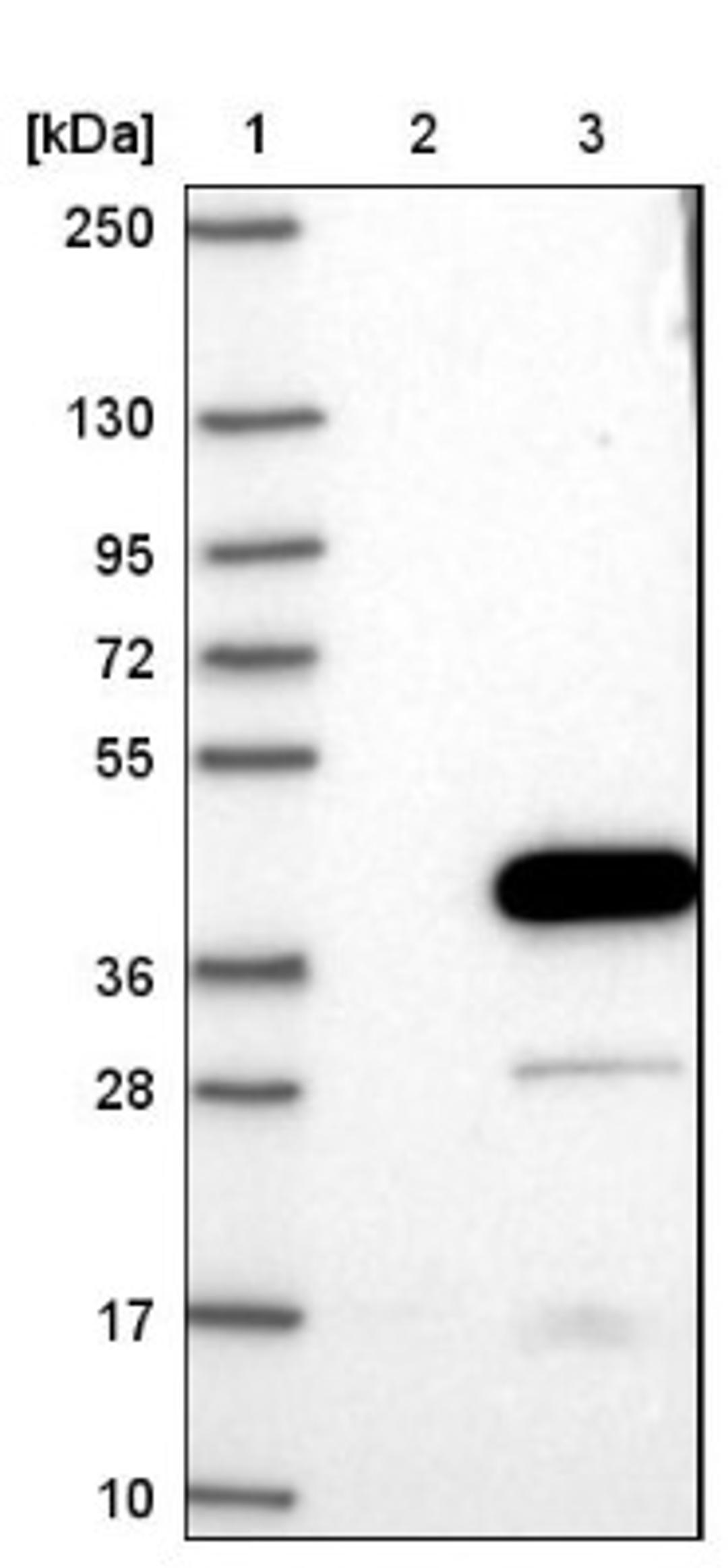 Western Blot: Estrogen Sulfotransferase Antibody [NBP1-84785] - Lane 1: Marker [kDa] 250, 130, 95, 72, 55, 36, 28, 17, 10<br/>Lane 2: Negative control (vector only transfected HEK293T lysate)<br/>Lane 3: Over-expression lysate (Co-expressed with a C-terminal myc-DDK tag (~3.1 kDa) in mammalian HEK293T cells, LY417314)