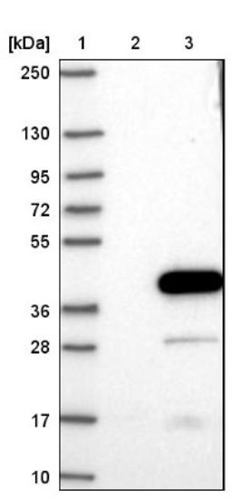 Western Blot: Estrogen Sulfotransferase Antibody [NBP1-84785] - Lane 1: Marker [kDa] 250, 130, 95, 72, 55, 36, 28, 17, 10<br/>Lane 2: Negative control (vector only transfected HEK293T lysate)<br/>Lane 3: Over-expression lysate (Co-expressed with a C-terminal myc-DDK tag (~3.1 kDa) in mammalian HEK293T cells, LY417314)