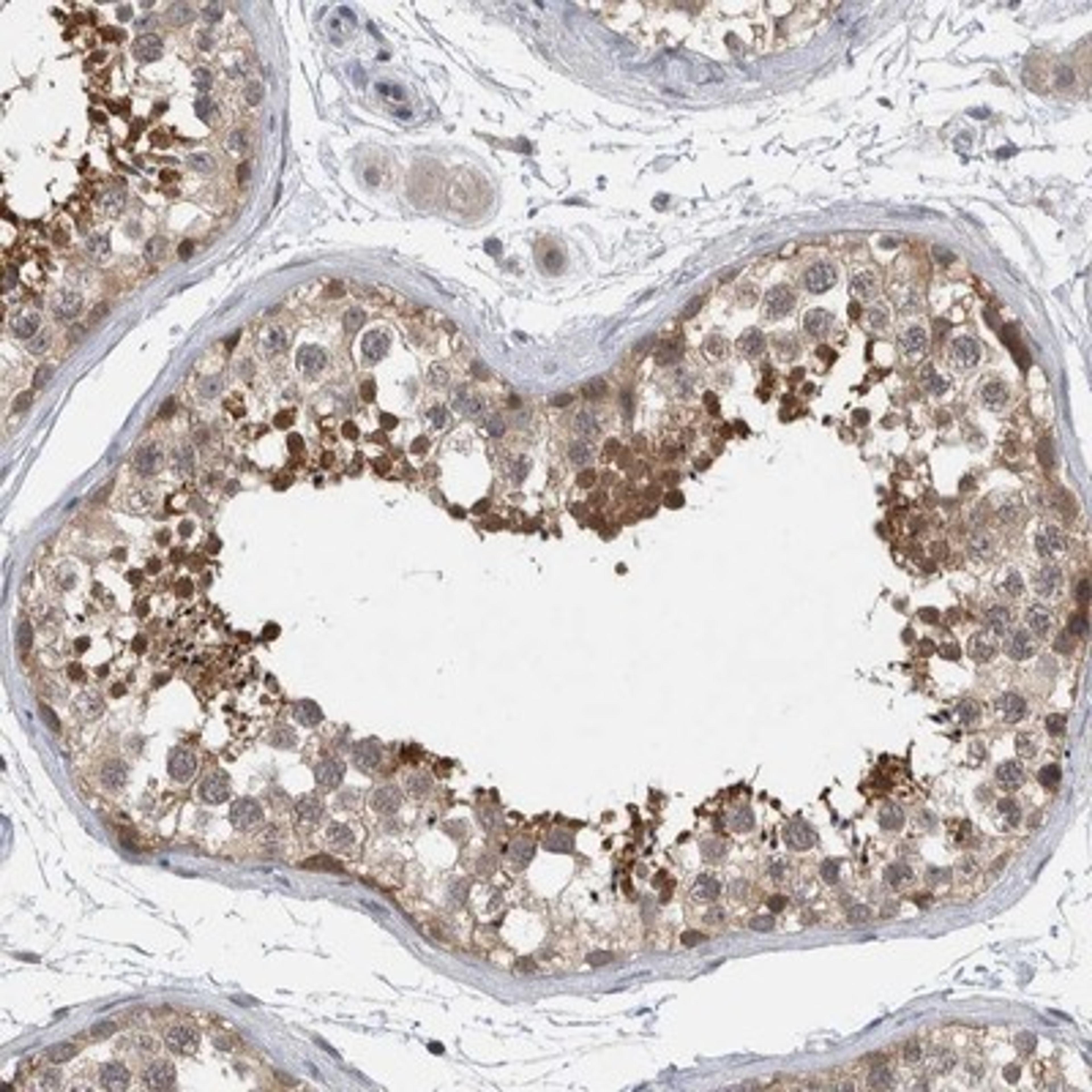 Immunohistochemistry-Paraffin: AASD-PPT Antibody [NBP1-89322] - Staining of human testis shows strong cytoplasmic positivity in spermatids.