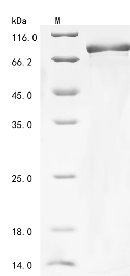 (Tris-Glycine gel) Discontinuous SDS-PAGE (reduced) with 5% enrichment gel and 15% separation gel.