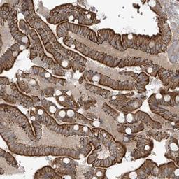 Immunohistochemistry-Paraffin: NAV3 Antibody [NBP1-82951] - Staining of human duodenum shows strong membranous and cytoplasmic positivity in glandular cells.