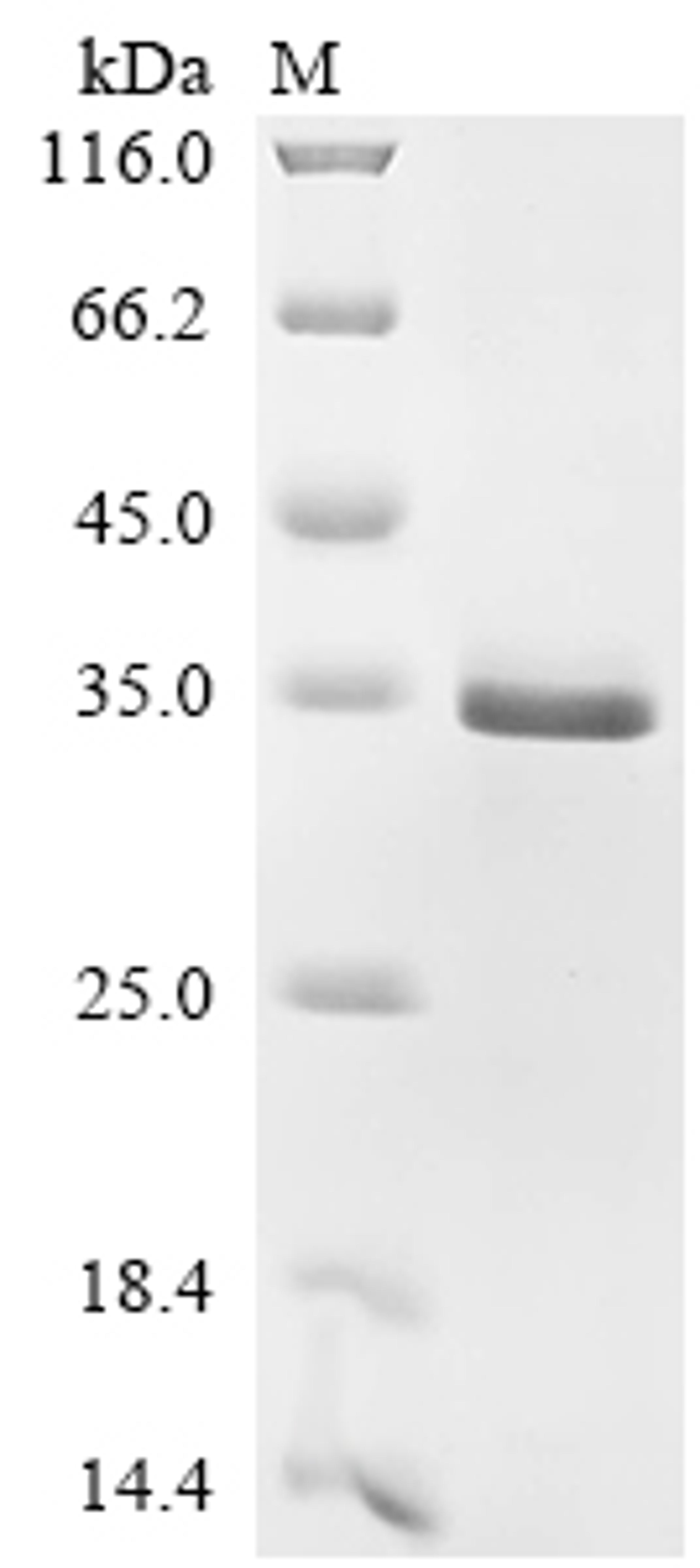 (Tris-Glycine gel) Discontinuous SDS-PAGE (reduced) with 5% enrichment gel and 15% separation gel.