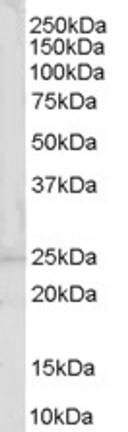 46-455 (0.3ug/ml) staining of Human Muscle lysate (35ug protein in RIPA buffer). Primary incubation was 1 hour. Detected by chemiluminescence.