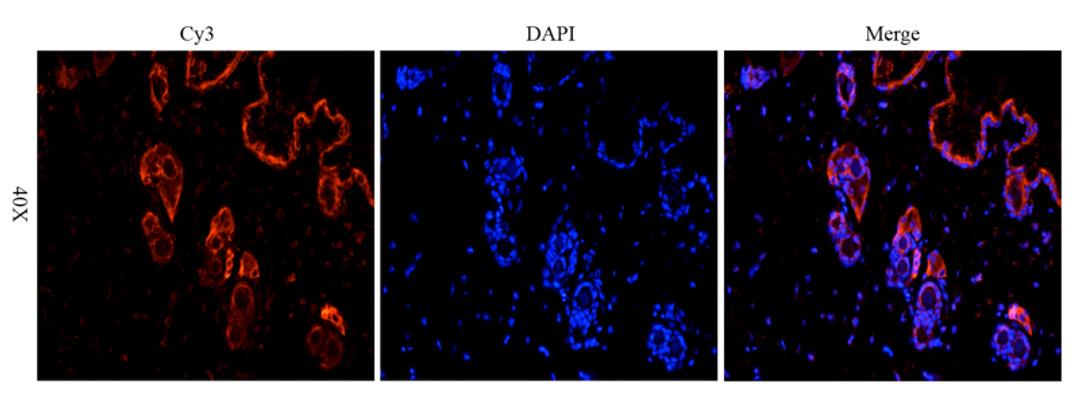 Immunofluorescence analysis of mouse skin tissue using Desmocollin 1 antibody (2.5 ug/ml)