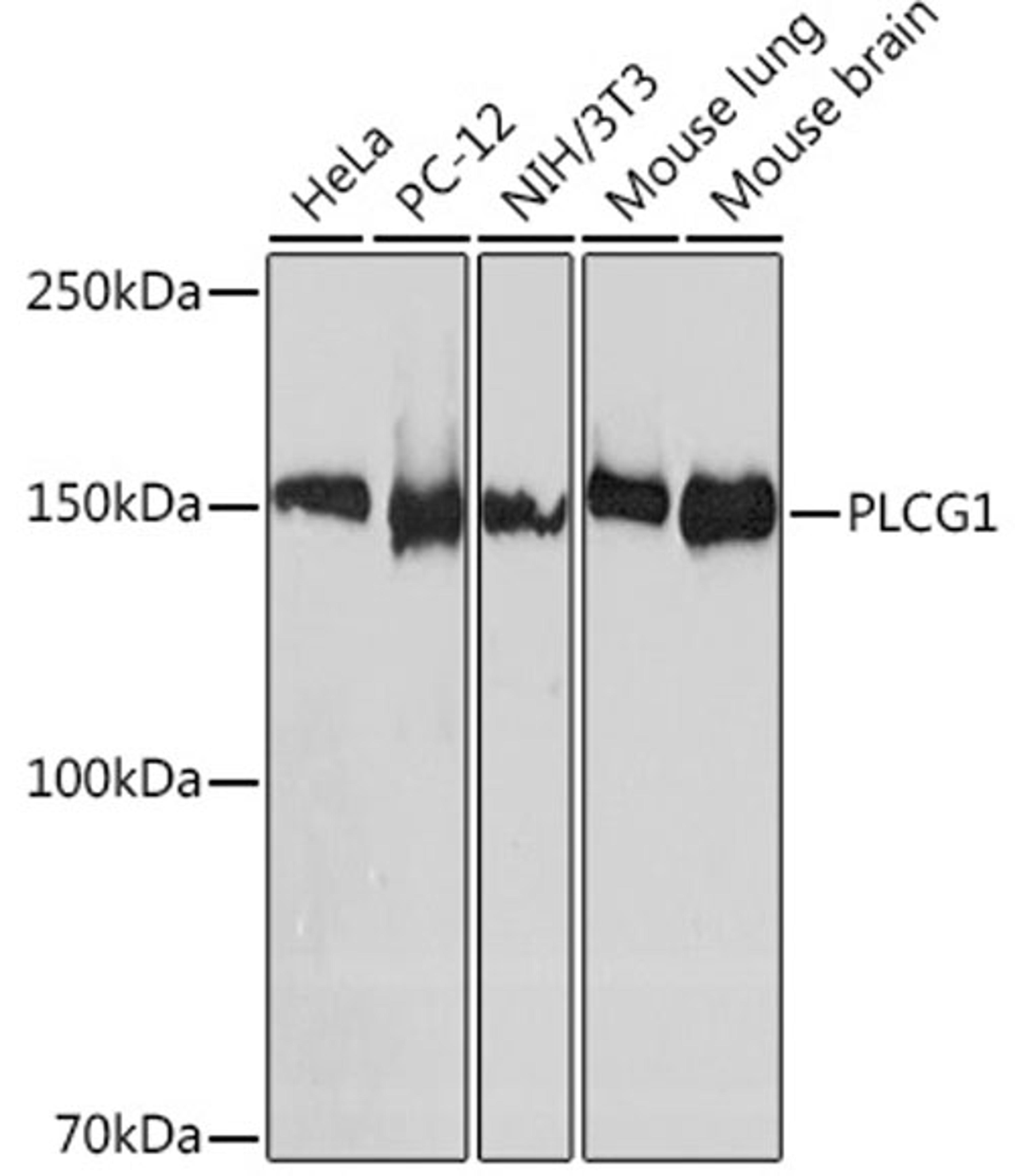 Western blot - PLCG1 Rabbit mAb (A8899)