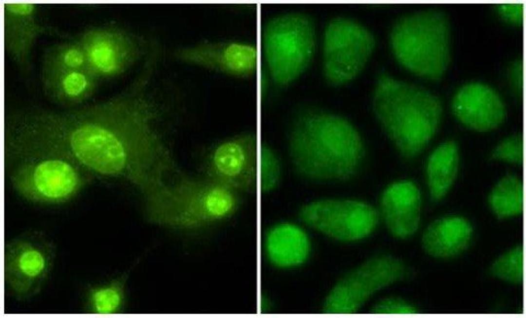 Immunofluorescence analysis of Mouse Dendritic cells tissue using Thyroid Hormone Receptor beta 1 antibody