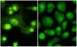 Immunofluorescence analysis of Mouse Dendritic cells tissue using Thyroid Hormone Receptor beta 1 antibody