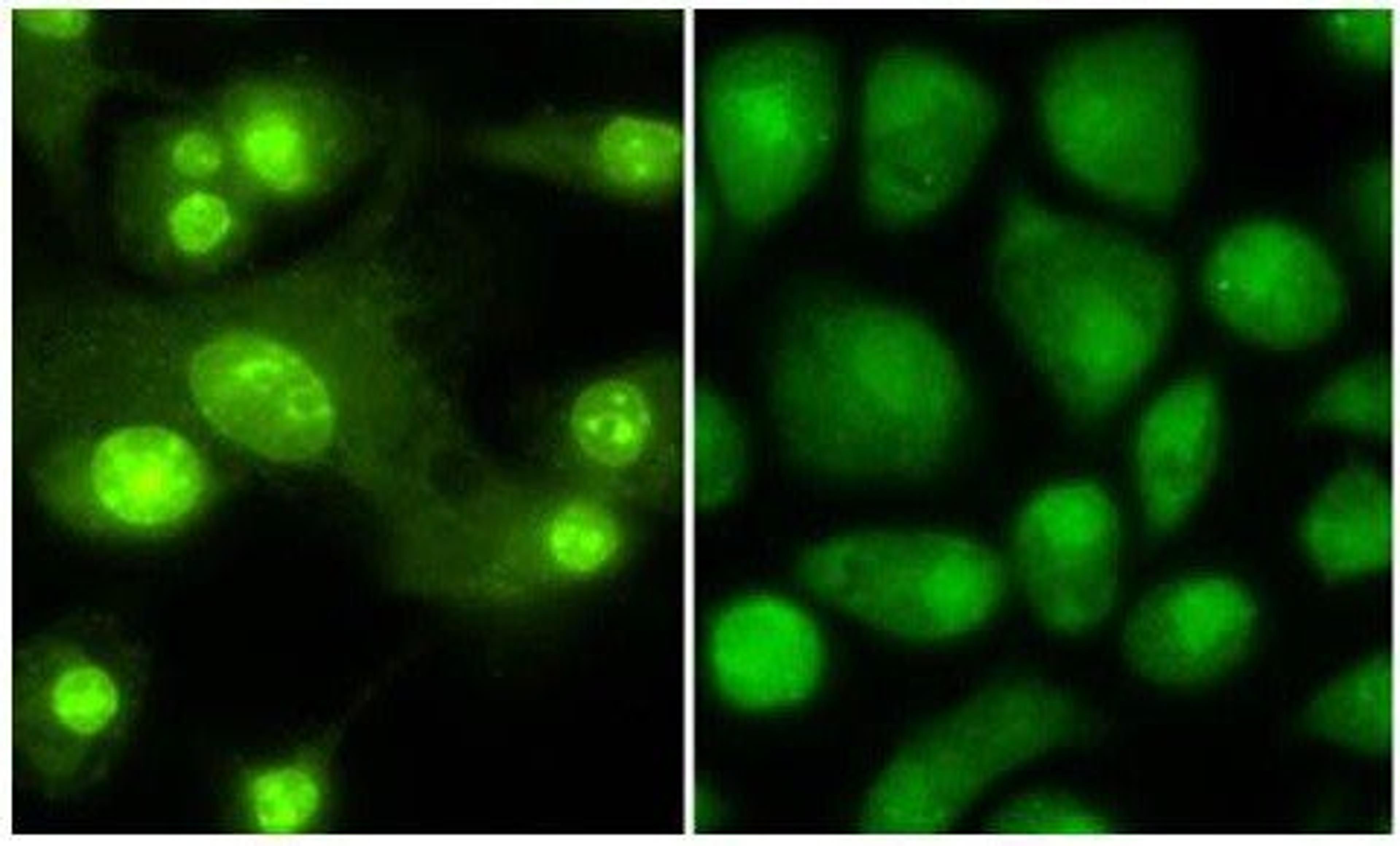 Immunofluorescence analysis of Mouse Dendritic cells tissue using Thyroid Hormone Receptor beta 1 antibody