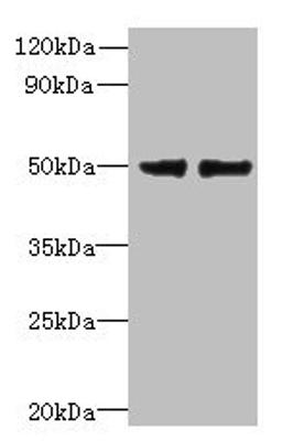 Western blot. All lanes: FAM118B antibody at 12ug/ml. Lane 1: Jurkat whole cell lysate. Lane 2: U251 whole cell lysate. Secondary. Goat polyclonal to rabbit IgG at 1/10000 dilution. Predicted band size: 39 kDa. Observed band size: 39 kDa. 