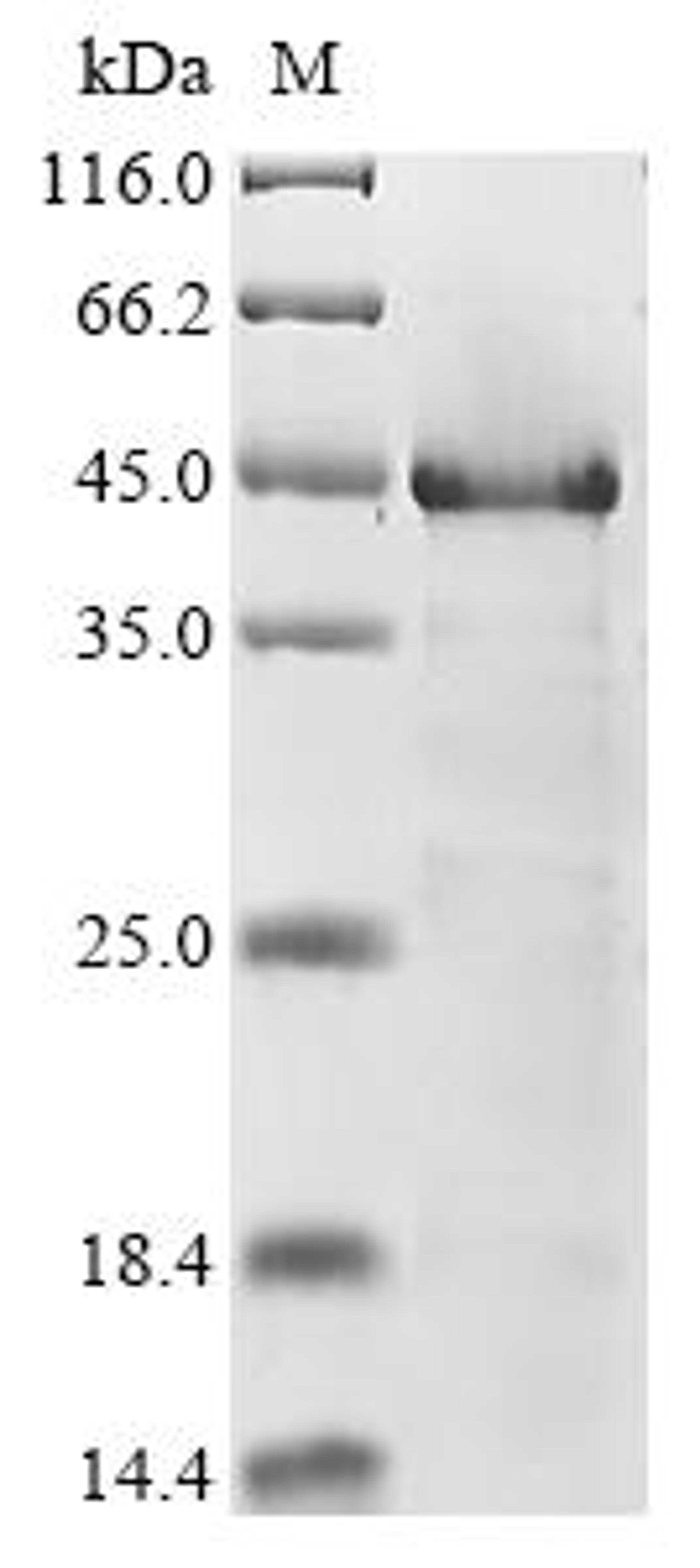 (Tris-Glycine gel) Discontinuous SDS-PAGE (reduced) with 5% enrichment gel and 15% separation gel.