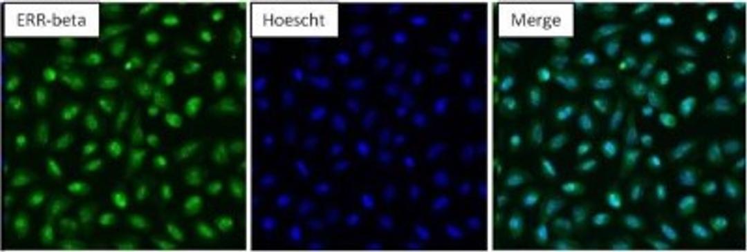 Immunocytochemistry/Immunofluorescence: ERR beta/NR3B2 Antibody [NB300-748] - Analysis of Estrogen Related Receptor beta (green) in NRK cells. Formalin-fixed cells were permeabilized with 0.1% Triton X-100 in TBS for 10 minutes at room temperature and blocked with 5% normal goat serum for 15 minutes at room temperature. Cells were probed with a Estrogen Related Receptor beta polyclonal antibody at a dilution of 1:100 for at least 1 hour at room temperature, washed with PBS, and incubated with DyLight 488-conjugated goat anti-rabbit IgG secondary antibody at a dilution of 1:400 for 30 minutes at room temperature. Nuclei (blue) were stained with Hoechst 33342 dye.