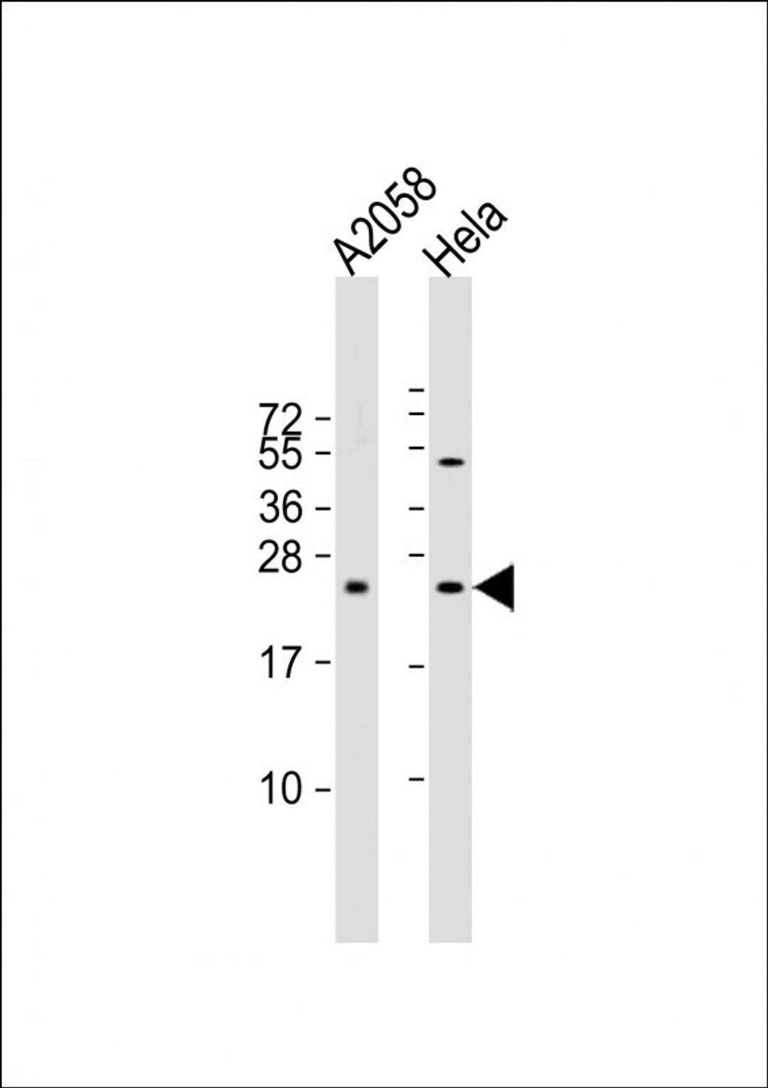 Western Blot at 1:2000 dilution Lane 1: A2058 whole cell lysate Lane 2: Hela whole cell lysate Lysates/proteins at 20 ug per lane.