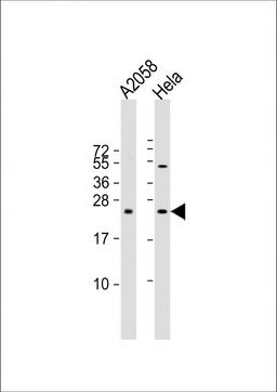 Western Blot at 1:2000 dilution Lane 1: A2058 whole cell lysate Lane 2: Hela whole cell lysate Lysates/proteins at 20 ug per lane.